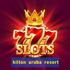 hilton aruba resort and casino