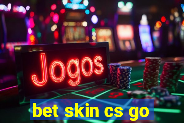 bet skin cs go