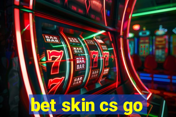 bet skin cs go