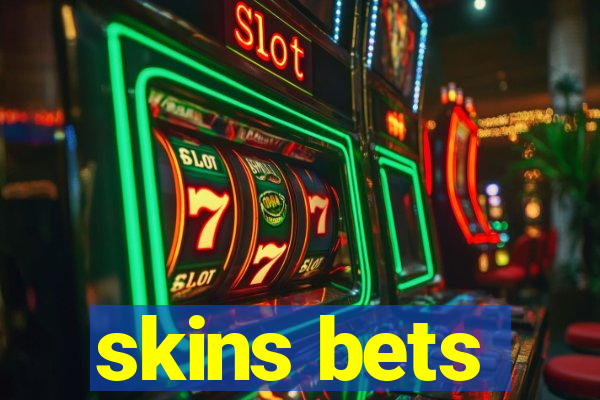 skins bets